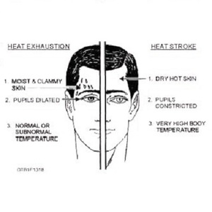 Heat Stroke Exhaustion Symptoms