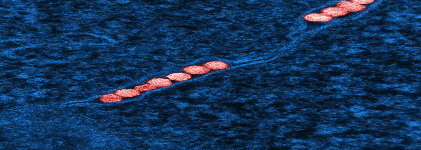 West Nile Virus